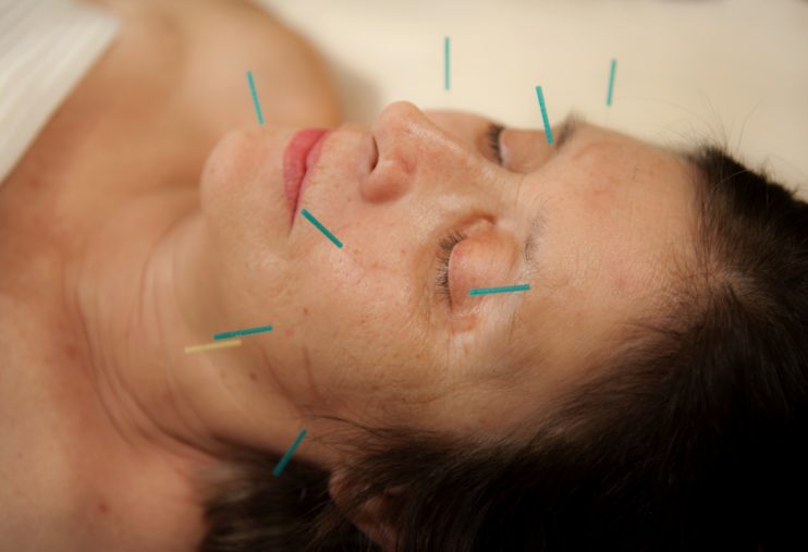 facial acupuncture, auriculotherapy, fertility acupuncture near me